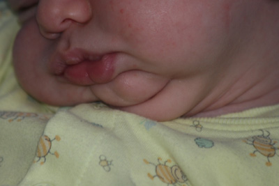 fat-chin.jpg